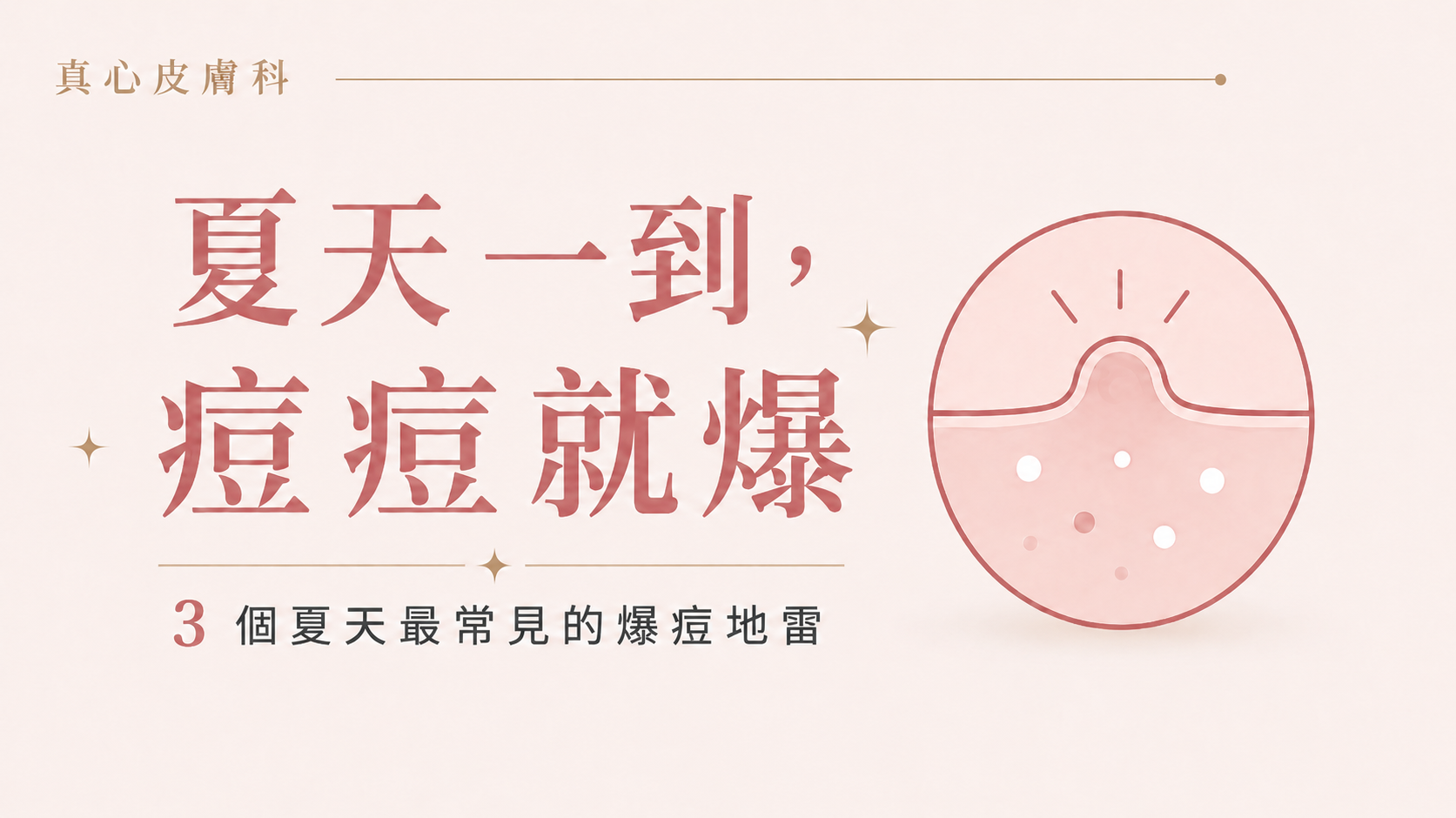 夏天一到，痘痘就爆